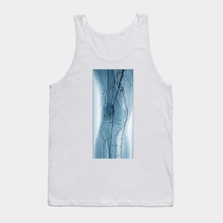 Peripheral vascular disease in diabetes (C029/9941) Tank Top